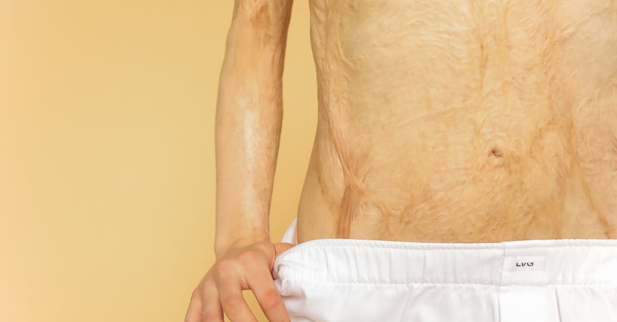 What are the three pain management techniques?